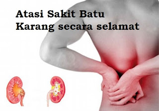 sebab sakit batu karang, ubat batu karang, shaklee bintulu, pengedar shaklee bintulu, bintulu, testimoni sakit batu karang