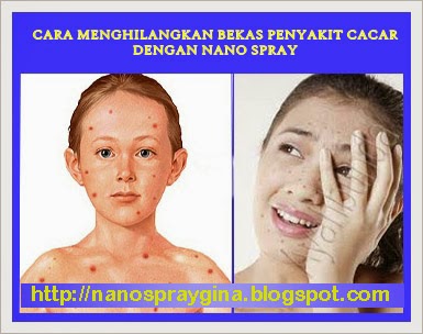 Testimoni Manfaat Nano Spray 2 dan Magic Stick MCI Bagi Kulit Wajah