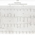 ECG Interpretations