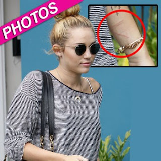 miley con cortes en el brazo izquierdo