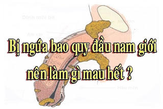 Bị ngứa bao quy đầu nam giới nên làm gì mau hết ?