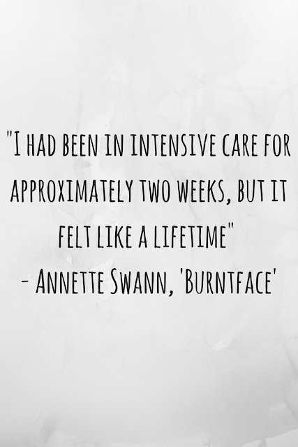 Review of 'Burntface: Scarred for Life' by Annette Swann