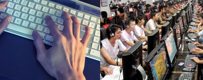 Remaja Cina Memotong Tangannya Karena Kecanduan Internet