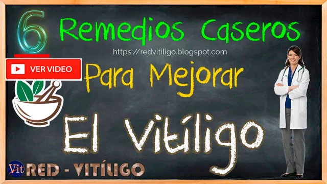 Remedios Caseros Naturales Para el Vitiligo