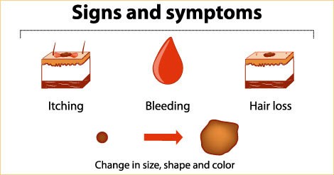 Cancer, Cancer signs and symptoms, Health