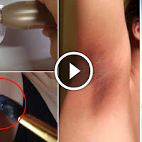 How To Get Rid Of Dark Underarm - Armpits Naturally!