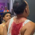 Ver video;: Cerca de las 12 de la noche una persecución policial deja una persona interna en el Hospital. Hay evidencia de agresión física.