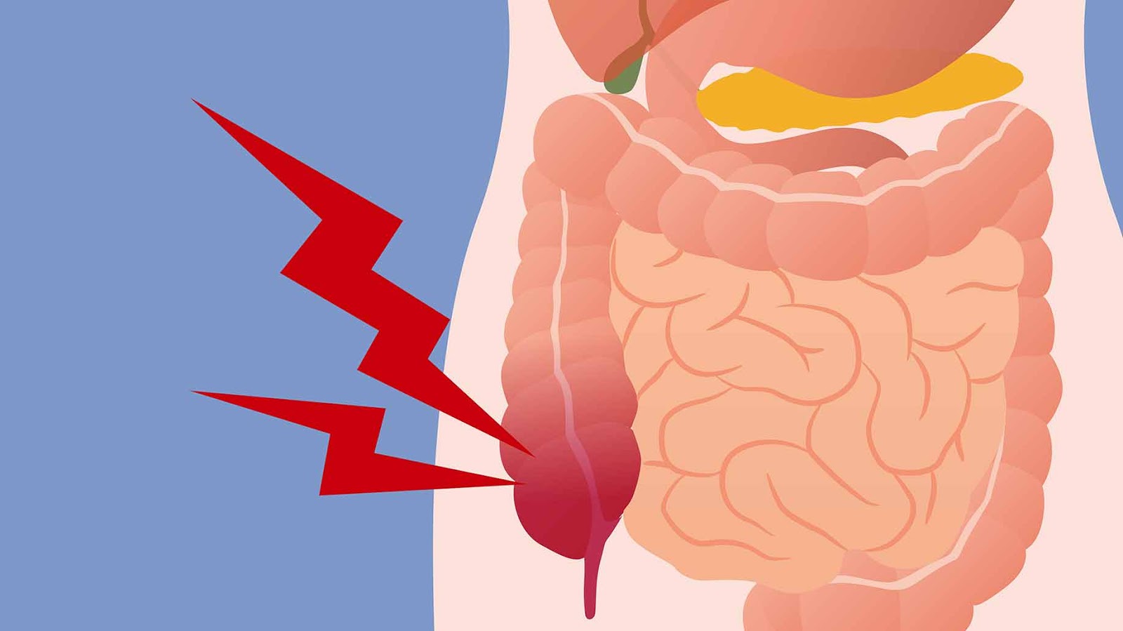 Get Rid Of 11 Lbs Of Waste From Your Colon With This Juice