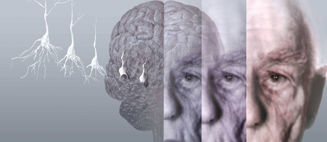 Lítio estabiliza memória de idosos com Alzheimer