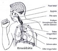 ramuan penyakit bronkhitis