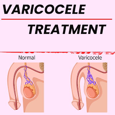 Varicocele treatment_https://bharathomeopathy.com/varicocele/