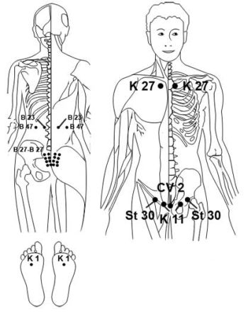 Electroacupuncture and Acupressure cure premature ejaculation