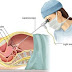 Cost of Laparoscopy in Noida