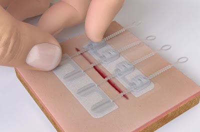 ZipStitch Laceration Kit, Close Your Gaping Wound Without Having To Go To Emergency Room For Stitches