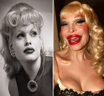 Shocking Celebrity Plastic Surgery Transformations