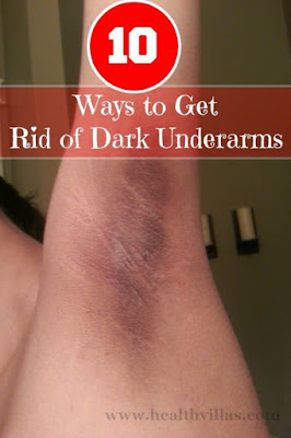 Brilliant Ways To Get Rid of Dark Underarms