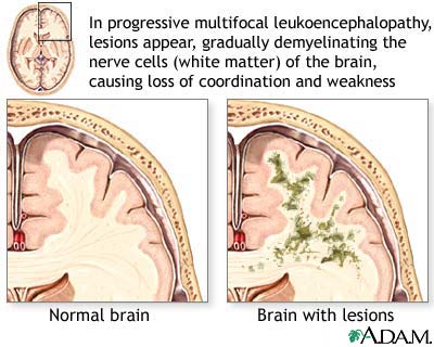 Brain White Matter6