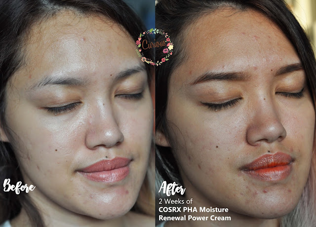 Cosrx PHA Moisture Renewal Power Cream Before After