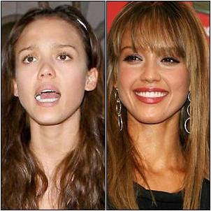 jessica alba teeth