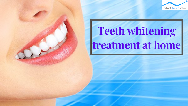 Teeth whitening