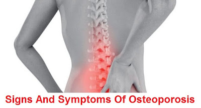 osteoporosis: causes, signs-symptoms, diagnosis and treatment