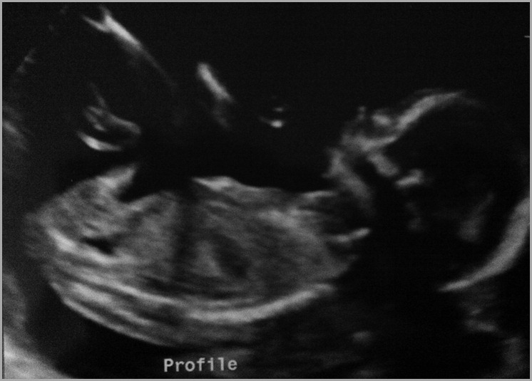 baby#2profile