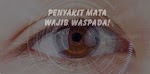 Jenis-Jenis Penyakit Mata yang Perlu Diwaspadai