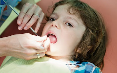 Khi nào nhổ răng sữa cho bé? 