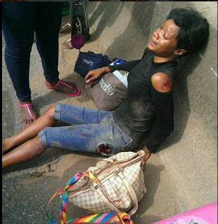 OMG!! Unidentified student involved in ghasty motor accident on her way back to school (PHOTOS)