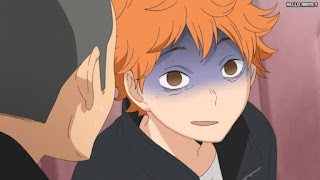 ハイキュー!! アニメ 第1期5話 日向翔陽 | HAIKYU!! Episode 5