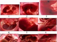 Bentuk Janin 6 Bulan Dalam Kandungan