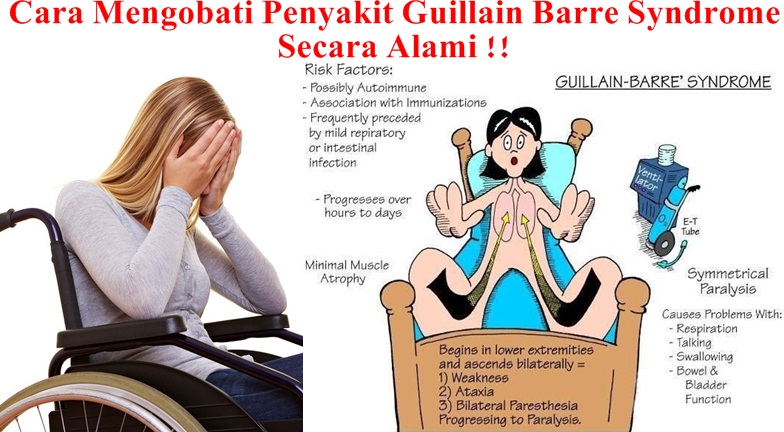 Pengobatan Tradisional Guillain Barre Syndrome