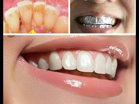 طريقة مبتكرة بالبيت لتبييض الاسنان والتخلص من الجير احسن من صالونات التجميل