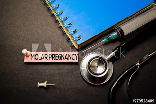 Molar pregnancy 