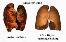 cancer risk after quitting smoking