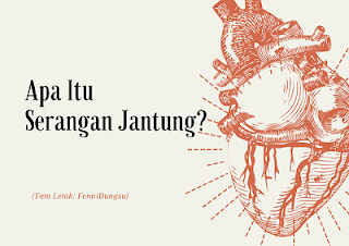 Cara mengenali serangan jantung, apa itu serangan jantung, mengapa terjadi serangan jantung, apa gejala serangan jantung, siapa saja yang bisa terkena serangan jantung, usia berapa serangan jantung terjadi, apakah pria mengalami serangan jantung, apakah wanita mengalami serangan jantung, pengobatan serangan jantung, cara pencegahan serangan jantung, cara mengobati serangan jantung, dokter yang menangani serangan jantung, dokter yang menangani penyakit jantung, dokter halodoc serangan jantung, daftar dokter jantung di Jakarta, daftar dokter jantung di Indonesia, daftar dokter jantung di jawa, daftar dokter jantung di bali, makanan pemicu serangan jantung, cara mengunduh aplikasi halodoc, cara berkonsultasi dengan dokter, cara konsultasi di halodoc, dokter jantung terbaik di Jakarta, dokter jantung terbaik di Indonesia, biaya berobat jantung, mengapa jantung berakibat kepada kematian,