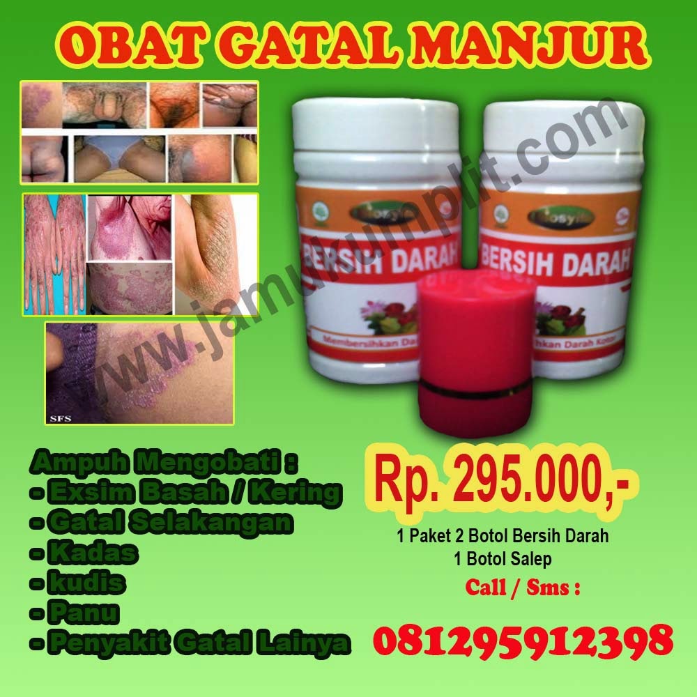 Obat gatal di selangkangan paha Pengobatan khusus gatal