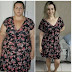 Após perder celular nas dobras da barriga, mulher conseguiu eliminar 65 kg