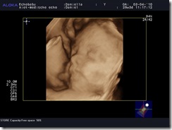 Daniella_20100403_REALTIME-_3D-__0058