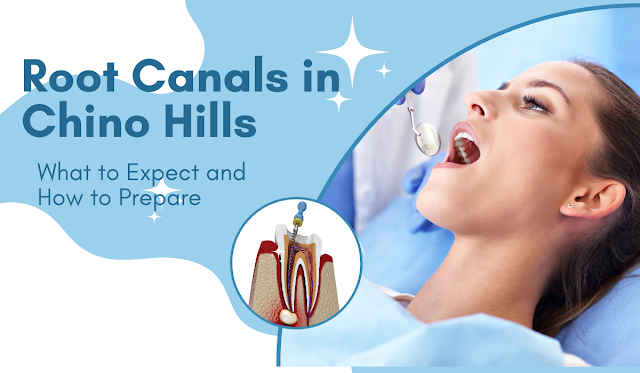 Root Canals in Chino Hills