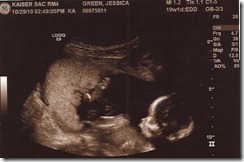 Baby3_profile3