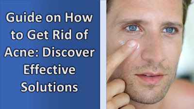 Guide on How to Get Rid of Acne: Discover Effective Solutions