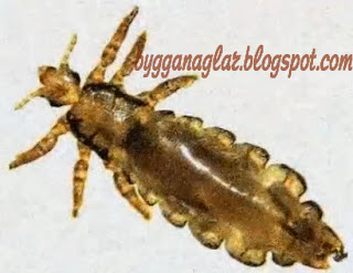 Harloss bilder  Head lice picture