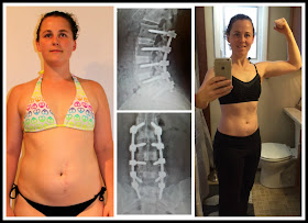 Tranformation, Back Issues, Challenge, Workout, 21 Day Fix Results, Transformation Story, Ultimate Reset Transformation