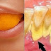 REMOVES PLAQUE AND WHITEN YOUR TEETH IN 15 MIN WITH THIS RECIPE THAT A DENTIST EVER YOU TELL!