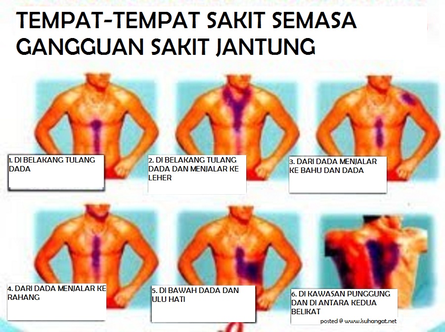 KESAN-KESAN OBESITI TERHADAP KITA ~ Natural Health 