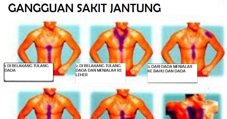 KESAN-KESAN OBESITI TERHADAP KITA ~ Natural Health 