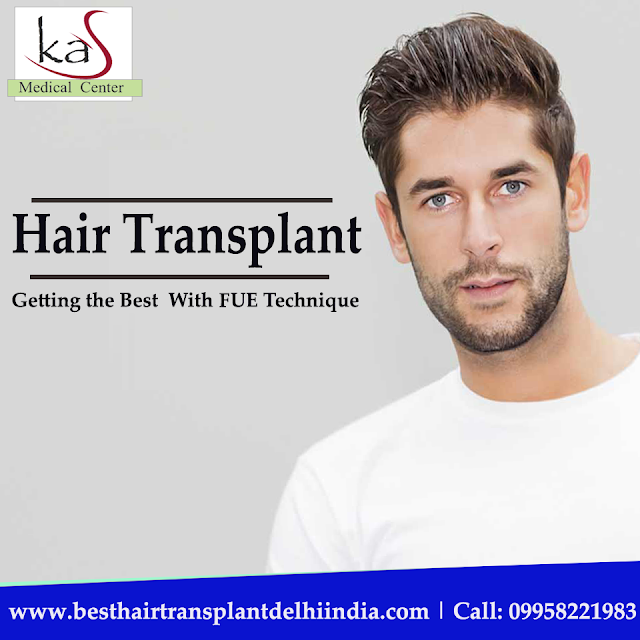 #HairLoss #HairTransplant  #HairSurgeon #HairCare #FUE #PRP #HairRepair #HairGrowth #HairRestoration #FUT #ClinicIndia #Delhi