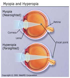 Dog Eyesight Problems