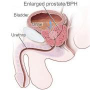 Prostate Gland Ayurveda